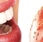 000002986202small_tooth_whitening