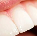 000009248063xsmall_hard_tissue