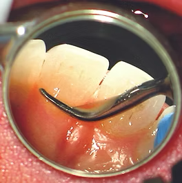 Everclear mirror after 6 sec Large