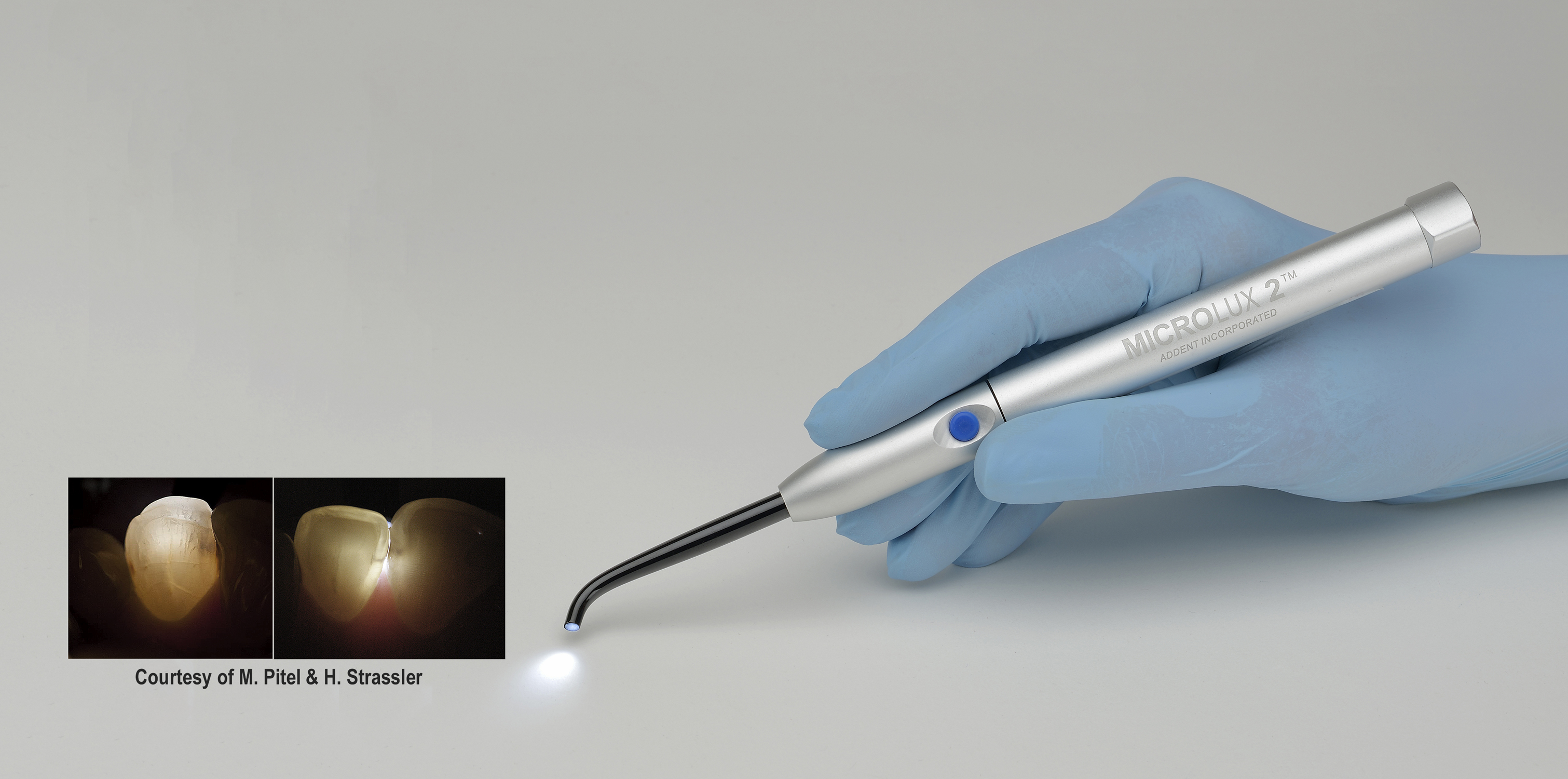 Microlux 2_Fracture_Caries Clinical