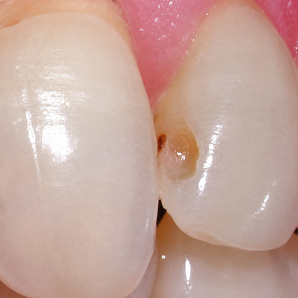 Treatment image
