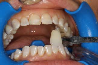 touchwhite after